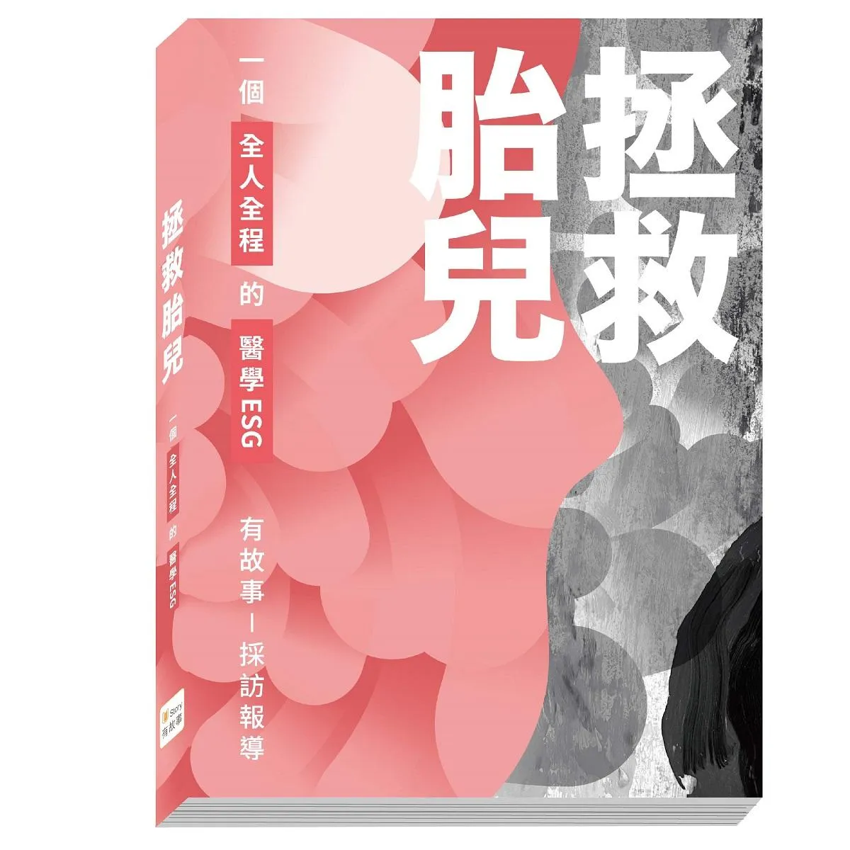 (結束代理)拯救胎兒：一個全人全程的醫學ESG