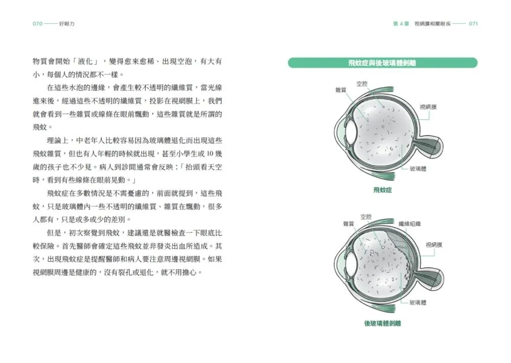 好眼力:台大眼科名醫楊中美教你正確認識及防護眼睛疾病
